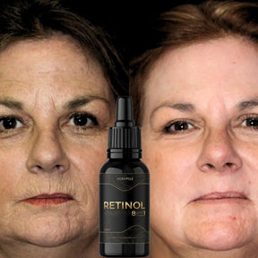Retinol 8 em 1 30ml – O Poder do Rejuvenescimento em Cada Gota - ESCOLHA UMA DAS OPÇÕES ABAIXO - 2 ou 4 FRASCOS - FRETE GRÁTIS - Brisa Loja